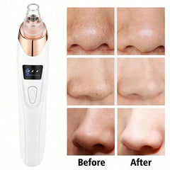 Rechargeable Pore Cleanser & Facial Suction Tool - Thumbnail 3