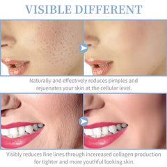 High-Frequency Glass Electrode Facial Therapy Wand - Thumbnail 3