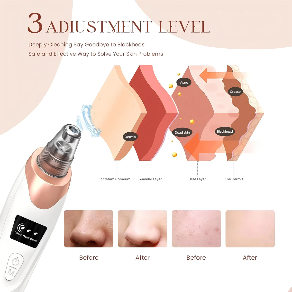 Rechargeable Pore Cleanser & Facial Suction Tool